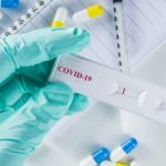 prueba test COVID-19