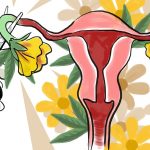 mujeres esterilización Nicaragua