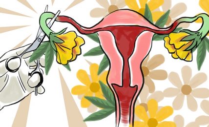 mujeres esterilización Nicaragua