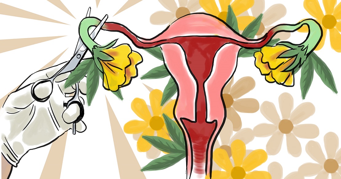 mujeres esterilización Nicaragua