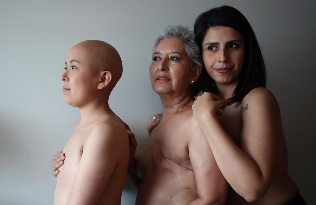 cáncer de mama OMS